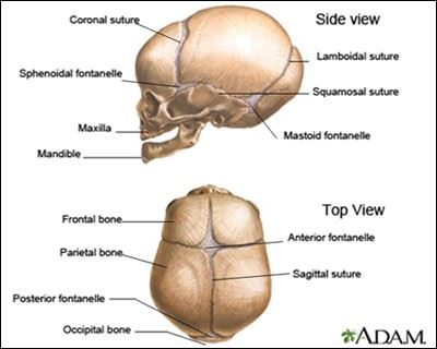 Cranial Birth Defects